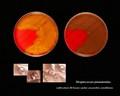 Streptococcus pneumoniae colony morphology, anaerobic cultivation and colony appearance